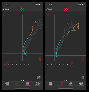 draw analysis